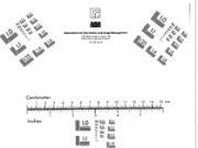 Seismic Safety of Earth Dam. A Probabilistic Approach